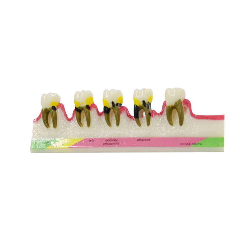 Medical Lab Study - Model chorób periodontologicznych Materiały dentystyczne Laboratorium