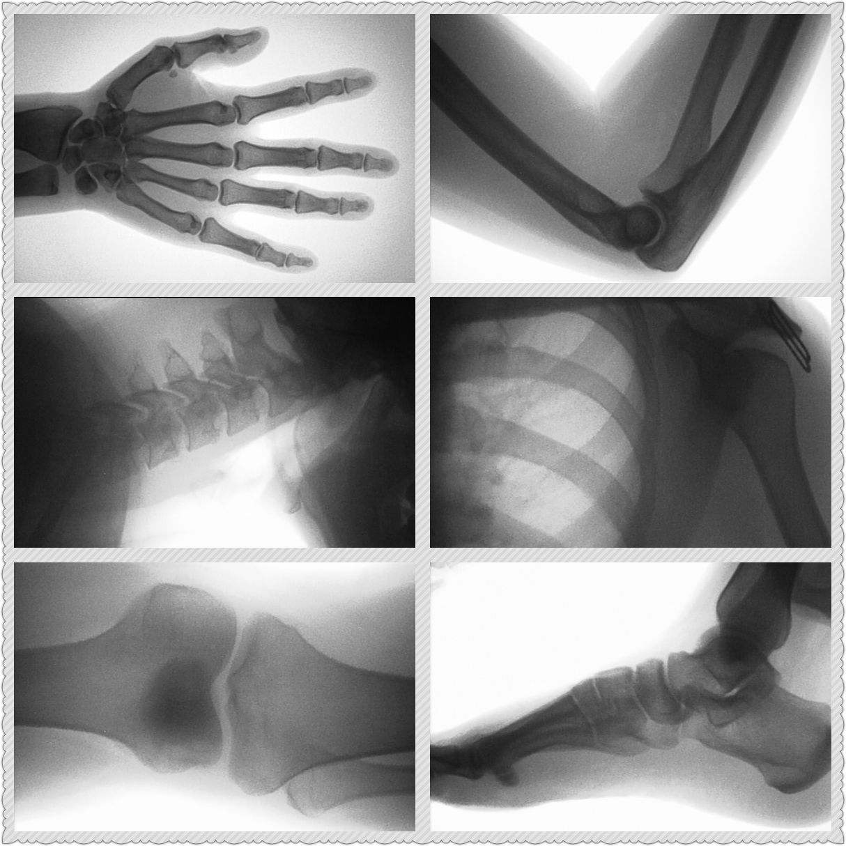 Szybka diagnostyka złamań u zw – Veterinary X-Ray recenzja i cena